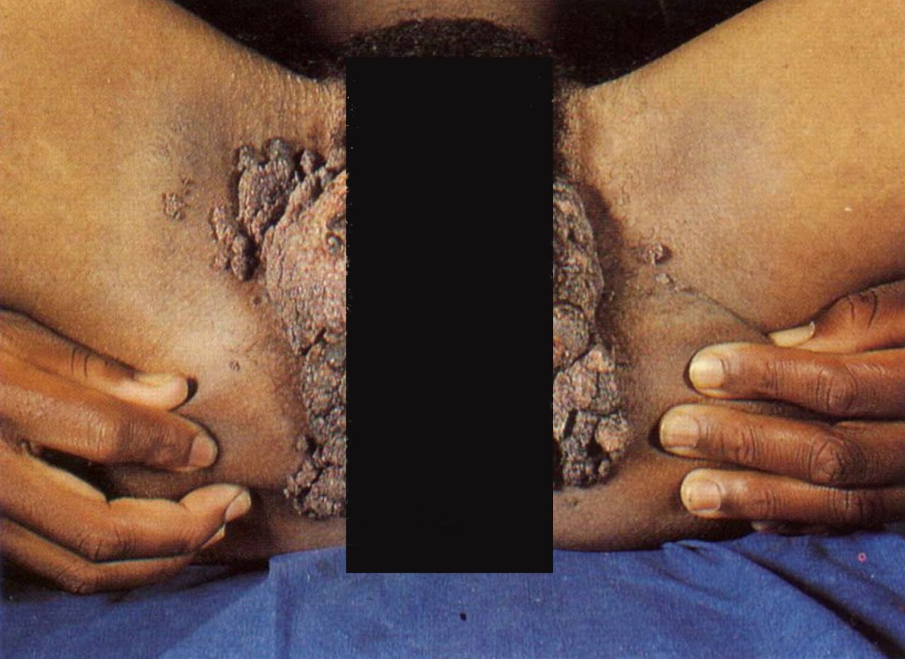 Вход 18+ 🔞. изуродованные половые органы - роды, аборты - почему трупам от...