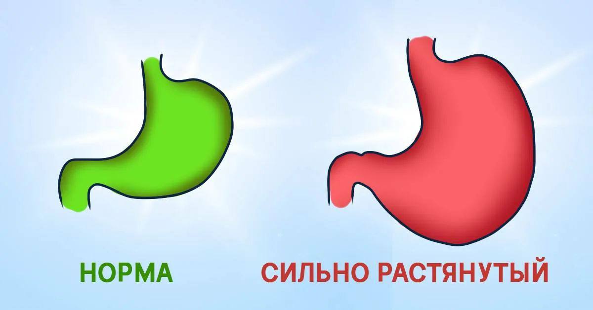 Как уменьшается желудок. Нормальный и растянутый желудок. картинку желудка растянутого.