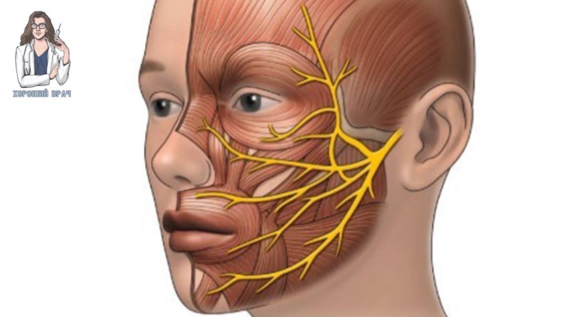 Прозопалгия тройничного нерва. Nervus facialis. Зоны иннервации тройничного нерва. Тройничный нерв на лице. Нейропатия тройничного нерва.