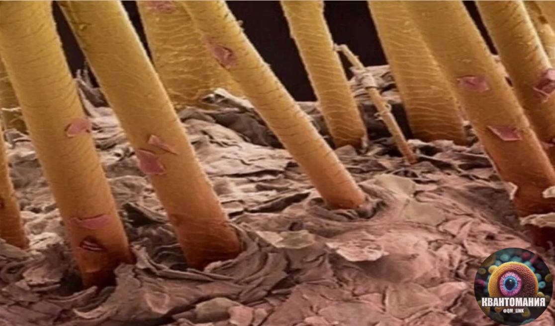 Грибок ногтей под микроскопом. Ногти под микроскопом 100 слоев. Как выглядят ногти под микроскопом. Как выглядят ногти под микроскопом. Микробы под ногтями под микроскопом.